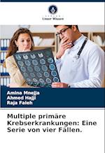 Multiple primäre Krebserkrankungen: Eine Serie von vier Fällen.