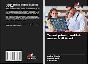 Tumori primari multipli: una serie di 4 casi