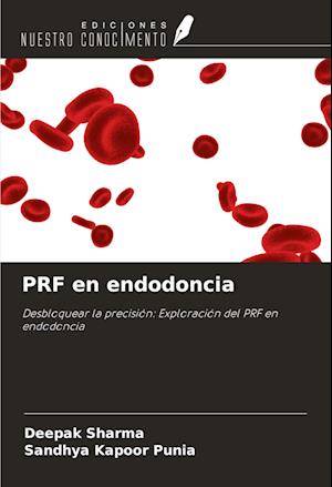 PRF en endodoncia