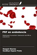 PRF en endodoncia