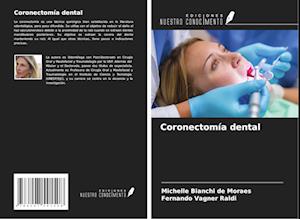 Coronectomía dental