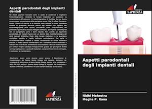 Aspetti parodontali degli impianti dentali