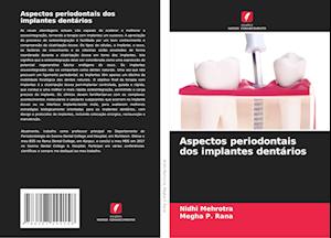 Aspectos periodontais dos implantes dentários