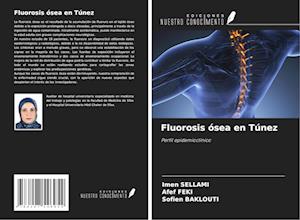 Fluorosis ósea en Túnez