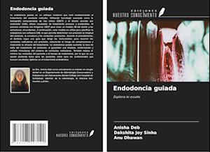 Endodoncia guiada