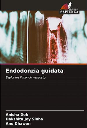 Endodonzia guidata