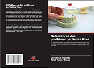 Défaillances des prothèses partielles fixes