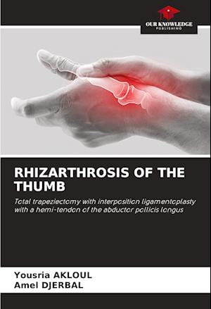 RHIZARTHROSIS OF THE THUMB