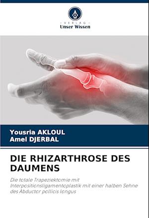 DIE RHIZARTHROSE DES DAUMENS