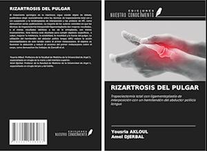 RIZARTROSIS DEL PULGAR