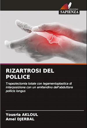 RIZARTROSI DEL POLLICE