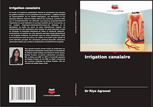 Irrigation canalaire