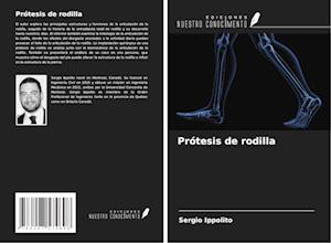 Prótesis de rodilla