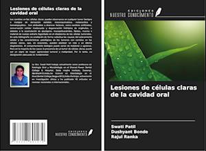 Lesiones de células claras de la cavidad oral