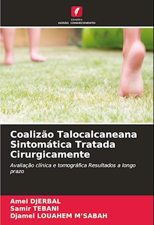 Coalizão Talocalcaneana Sintomática Tratada Cirurgicamente