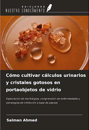 Cómo cultivar cálculos urinarios y cristales gotosos en portaobjetos de vidrio