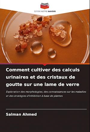 Comment cultiver des calculs urinaires et des cristaux de goutte sur une lame de verre