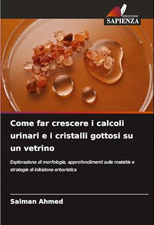 Come far crescere i calcoli urinari e i cristalli gottosi su un vetrino