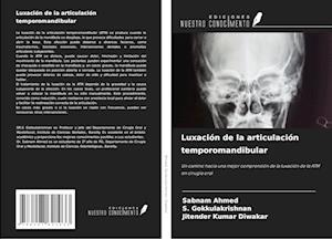 Luxación de la articulación temporomandibular