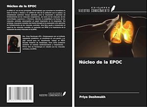 Núcleo de la EPOC