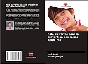 Rôle du vernis dans la prévention des caries dentaires