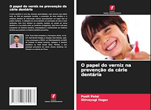 O papel do verniz na prevenção da cárie dentária