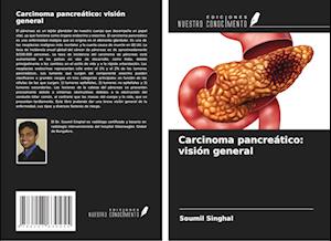 Carcinoma pancreático: visión general