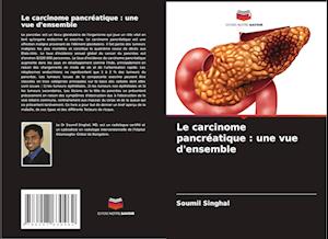 Le carcinome pancréatique : une vue d'ensemble