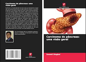 Carcinoma do pâncreas: uma visão geral