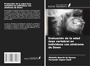 Evaluación de la edad ósea vertebral en individuos con síndrome de Down