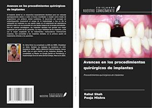 Avances en los procedimientos quirúrgicos de implantes