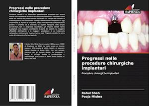 Progressi nelle procedure chirurgiche implantari