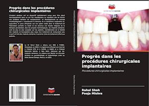 Progrès dans les procédures chirurgicales implantaires