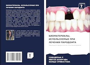 BIOMATERIALY, ISPOL'ZUEMYE PRI LEChENII PARODONTA