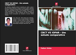 CBCT VS IOPAR - Um estudo comparativo