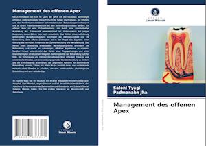 Management des offenen Apex