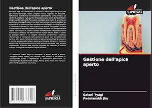 Gestione dell'apice aperto