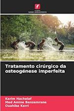 Tratamento cirúrgico da osteogénese imperfeita