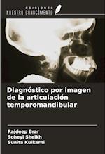 Diagnóstico por imagen de la articulación temporomandibular