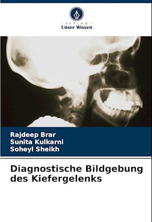 Diagnostische Bildgebung des Kiefergelenks