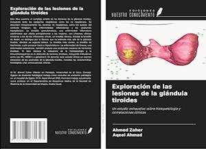 Exploración de las lesiones de la glándula tiroides