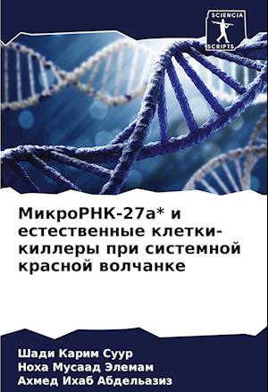 MikroRNK-27a* i estestwennye kletki-killery pri sistemnoj krasnoj wolchanke