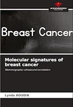 Molecular signatures of breast cancer