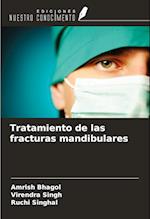 Tratamiento de las fracturas mandibulares