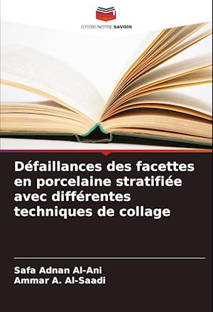 Défaillances des facettes en porcelaine stratifiée avec différentes techniques de collage