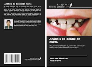 Análisis de dentición mixta