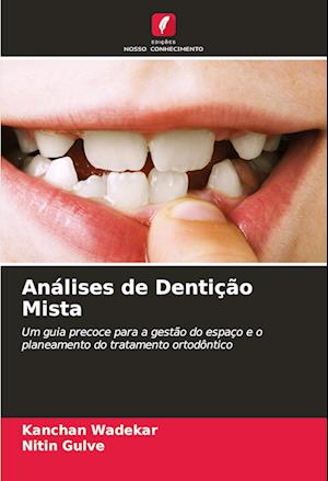 Análises de Dentição Mista