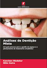 Análises de Dentição Mista