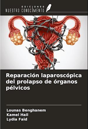 Reparación laparoscópica del prolapso de órganos pélvicos