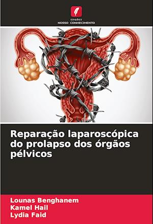 Reparação laparoscópica do prolapso dos órgãos pélvicos